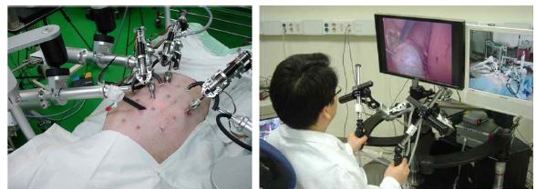 본 연구팀에 의해 개발된 복강경 수술 로봇