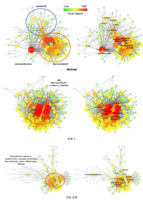 Network for cervical microbiome in normal, CIN 1, and CIN 2/3