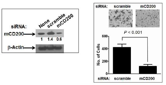 CD200의 발현을 억제하는 siRNA에 의한 invasion의 억제