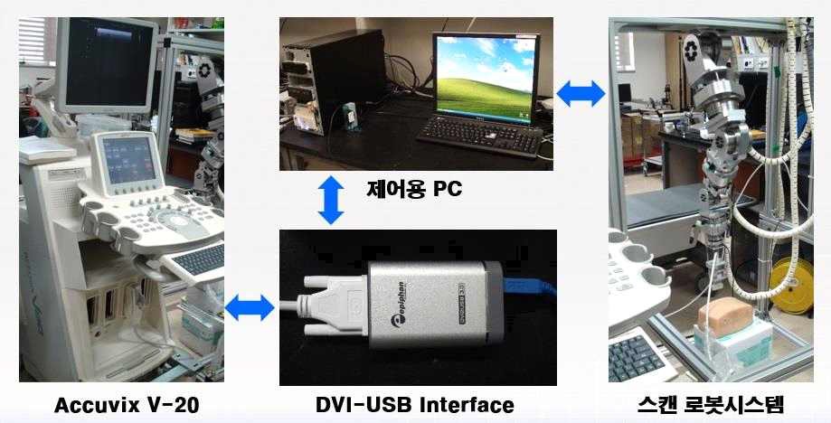 초음파 진단 로봇/스캐너 통합 시스템