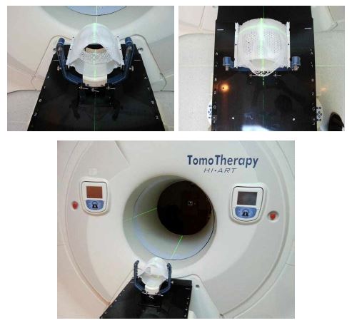 Brainlab 프레임, 고정시스템, lockbar를 이용하여 TomoTherapy 시스템에 장착한 모습으로 CT와 동일한 setup 재현이 가능함.
