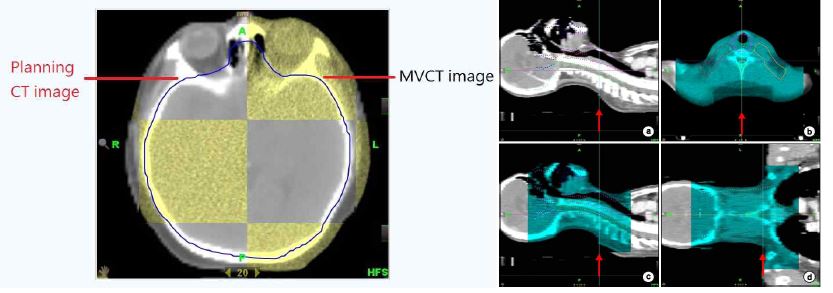 뇌종양(좌)과 두경부(우) 환자 치료에서 MVCT와 치료계획CT 비교 기능