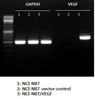 RT-PCR를 통한 NCI-N87-VEGF 세포주에서의 VEGF 과발현 확인 결과