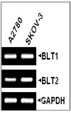 항암제 내성이 있는 세포주 에서 LTB4, 12(S)- HETE의 양이 증가됨을 확인