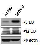 항암제 내성 세포주 SKOV-3와 내성이 없는 세포주 A2780 mRNA level 비교