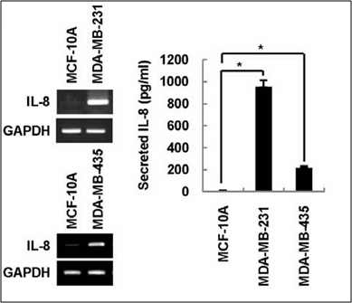 유방암 세포주에서 BLT2를 si RNA로 억제하였을 때, IL-8의 분비량이 감소함