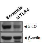 TLR4 억제에 의한 LTB4 생성 효소 변화 양상