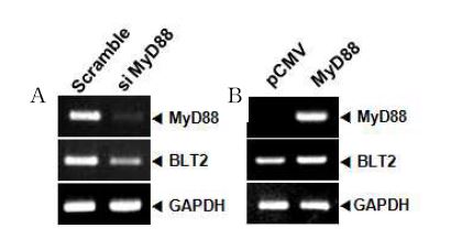 항암제 내성 난소암 세포주에서 MyD88 억제에 의한 BLT2 발현 변화 양상(A)항암제 민감성 난소암 세포주에서 MyD88 증가에 의한 BLT2 발현 변화 양상(B)