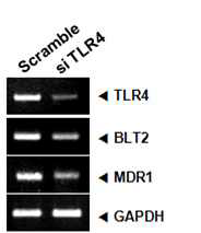 TLR4 억제에 의한 BLT2와 MDR1 발현 변화 양상