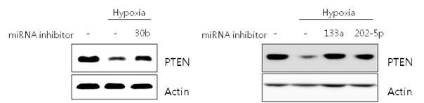 miR-30b, miR-133a, miR-202-5p inhibitor에 의한 PTEN 단백질 발현