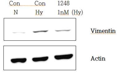 miR-1248 mimic에 의한 Vimentin 단백질 발현
