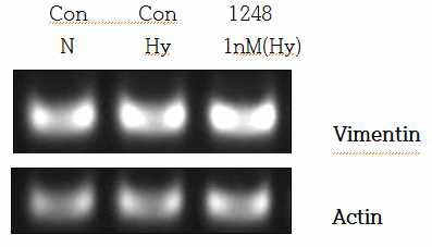 miR-1248 mimic에 의한 Vimentin mRNA 발현