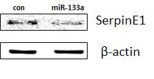 miR-133a에 의한 SerpinE1의 단백질 양의 감소