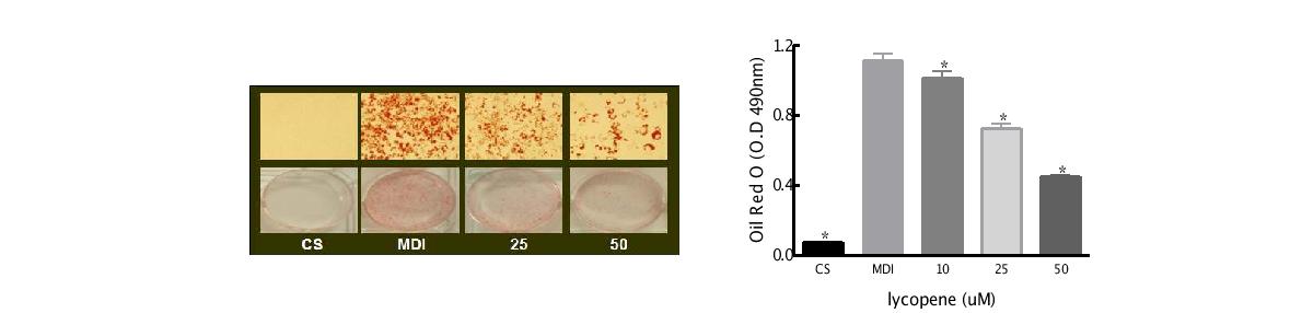 Anti-adipogenic effect of lycopene. Differentiated 3T3-L1 cells were stained with Oil red O.