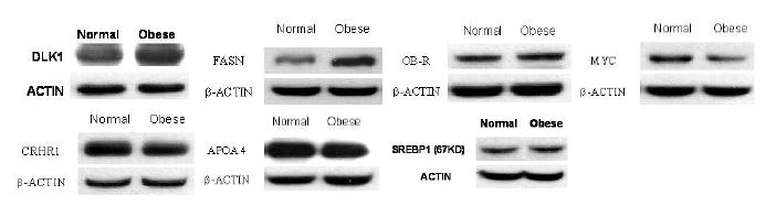 Analysis of protein expression by western blot analysis