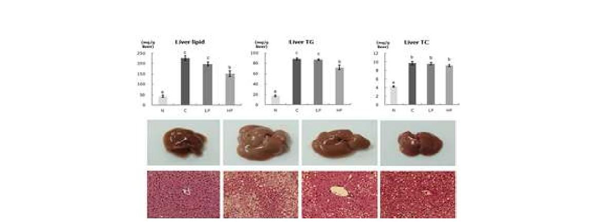 Effect of fisetin on lipid contents and histology of liver