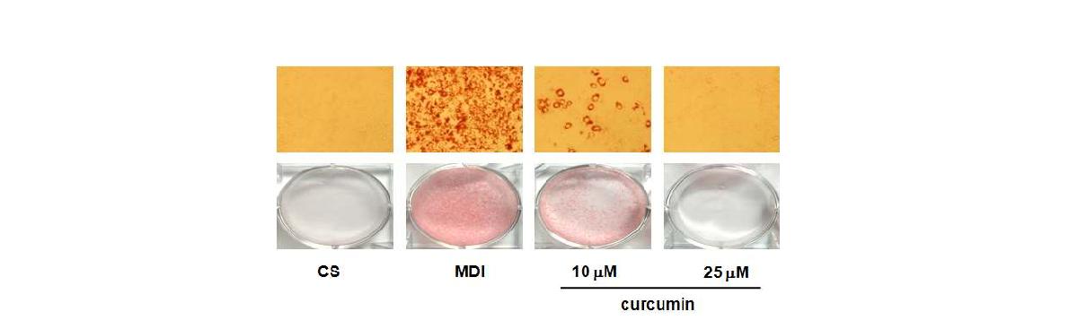 Anti-adipogenic effect of curcumin. Differentiated 3T3-L1 cells were stained with Oil red O.