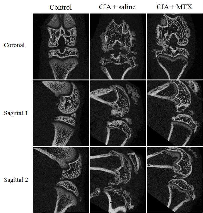 Coronal and sagittal micro-CT image of hind knee joint of rats treated with collagen at control, CIA + saline and CIA + MTX.