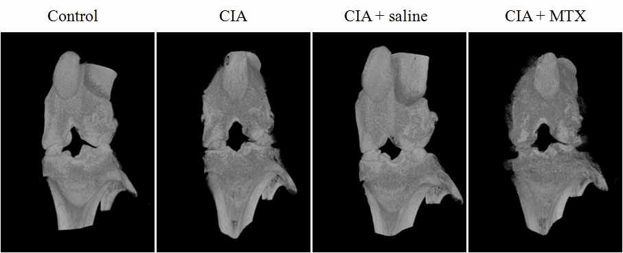 3D image of a collagen induced arthritis (CIA) left hind knee joint; control, CIA, CIA+saline, CIA+MTX.