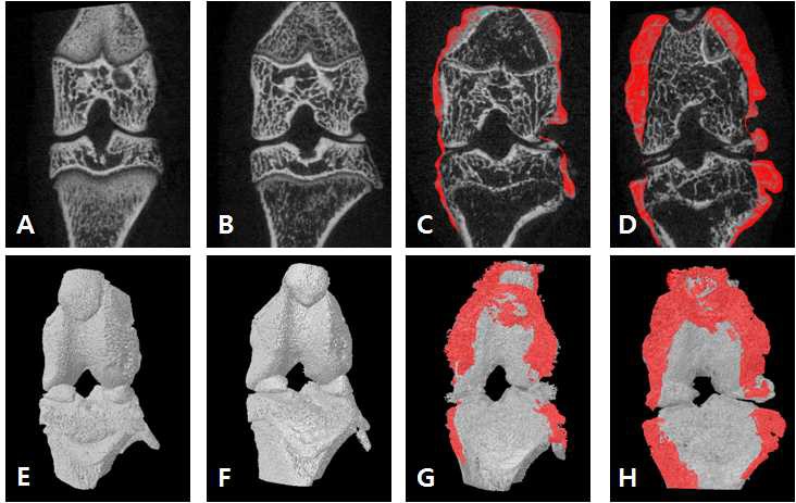 Visualizing of osteophytes in micro-CT coronal and 3D image of hind knee joint of rats treated with collagen at weeks 0, 2, 3 and 4.