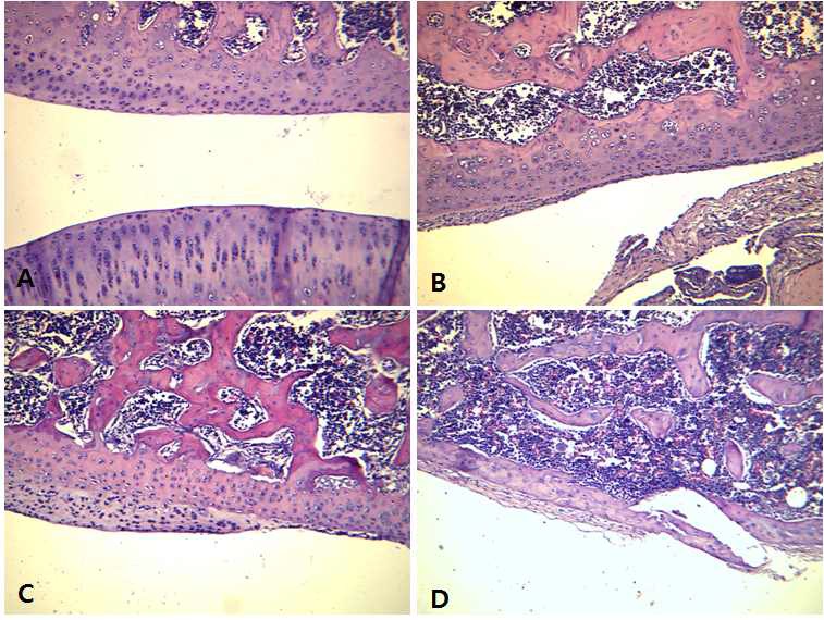 Pathological examination of hind knee joint of rats treated with collagen. (A) week 0; (B) week 2; (C) week 3; (D) week 4.