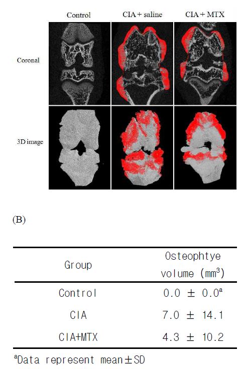 Visualizing of osteophytes in micro-CT coronal and 3D image of hind knee joint of rats treated with collagen at control, CIA + saline and CIA +　MTX. (A) Micro-CT view, (B) Calculation of osteophyte volume.