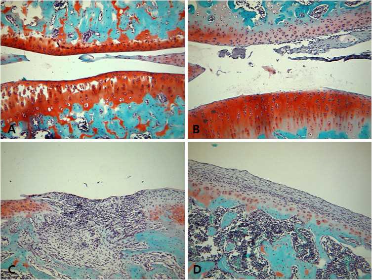 Safranin O-fast green staining of hind knee joint of rats treated with collagen. (A) week 0; (B) week 2; (C) week 3; (D) week 4.