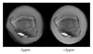 9.4T에서 구현된 CEST 펄스시퀀스의 성능 검증을 위해 돼지무릎 관절에서 얻은 S(δ = -1 ppm)과 S(δ = +1 ppm) 영상