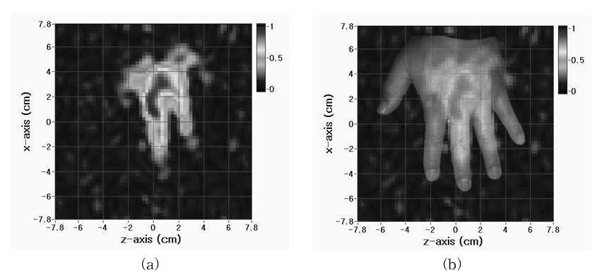 (a) MR image of human hand (b) Picture combined MR image and human hand.