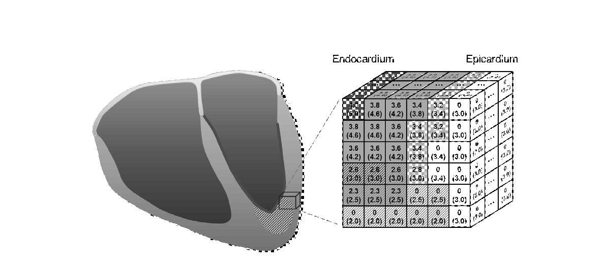 Conceptual diagram of a 3-D cellular automata model for describing an effective refractory period (ERP) of myocardial action potential profile. The upper number denotes a residual ERP of each cell at a certain sequence whereas the lower number in parenthesis represents an intrinsic ERP. The thick line and darkest cells are initial pacemakers, then, the gray cells are currently excited cells. The oblique cells express the ischemic regions, and the white with zero number cells indicate yet excited myocardium.