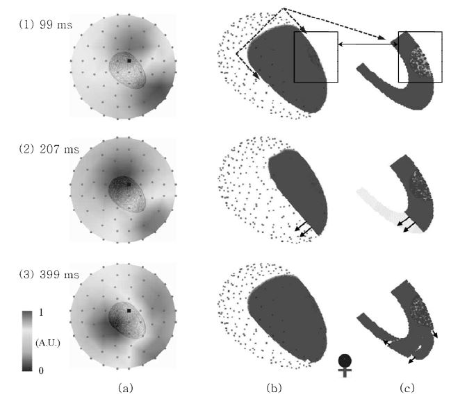 Generation of micro-reentrant excitations during acute myocardial ischemia.