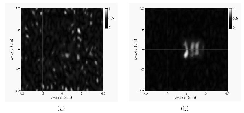 The MREIT MR images obtained by applying the modulation voltages (V MOD ) of (a) 2 and (b) 10 V.