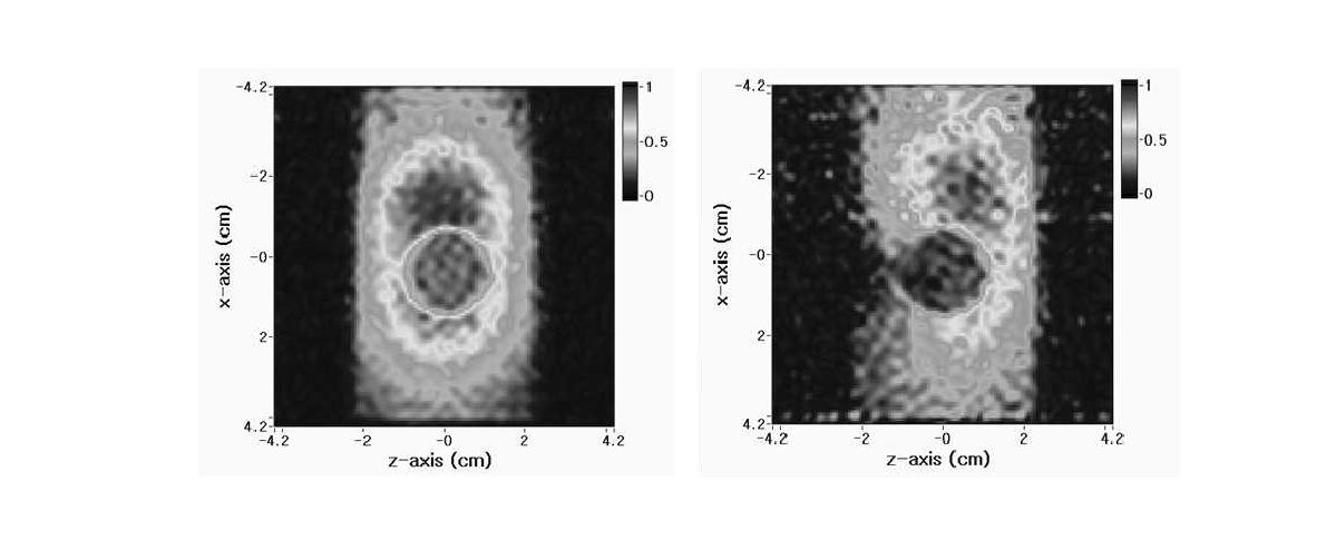 (a) Proton density MR image of the MREIT phantom. (b) MR image of the MREIT phantom without applying the BMOD .