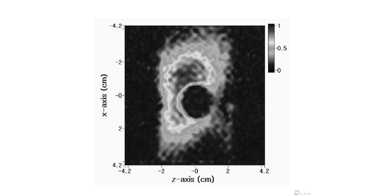 MR image of the MREIT phantom with applying the BMOD .