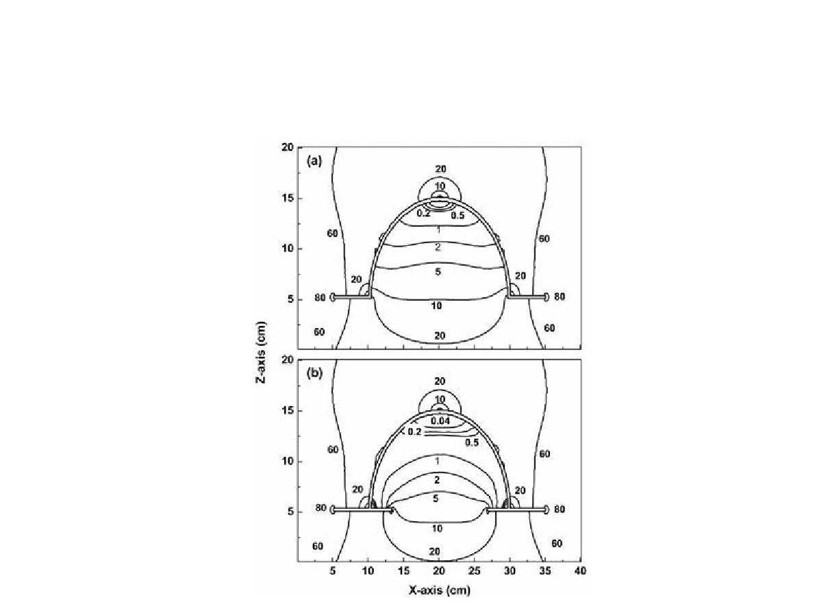 Simulation results of field distribution inside the helmet type superconductive shield by the external field generated by the cold head.