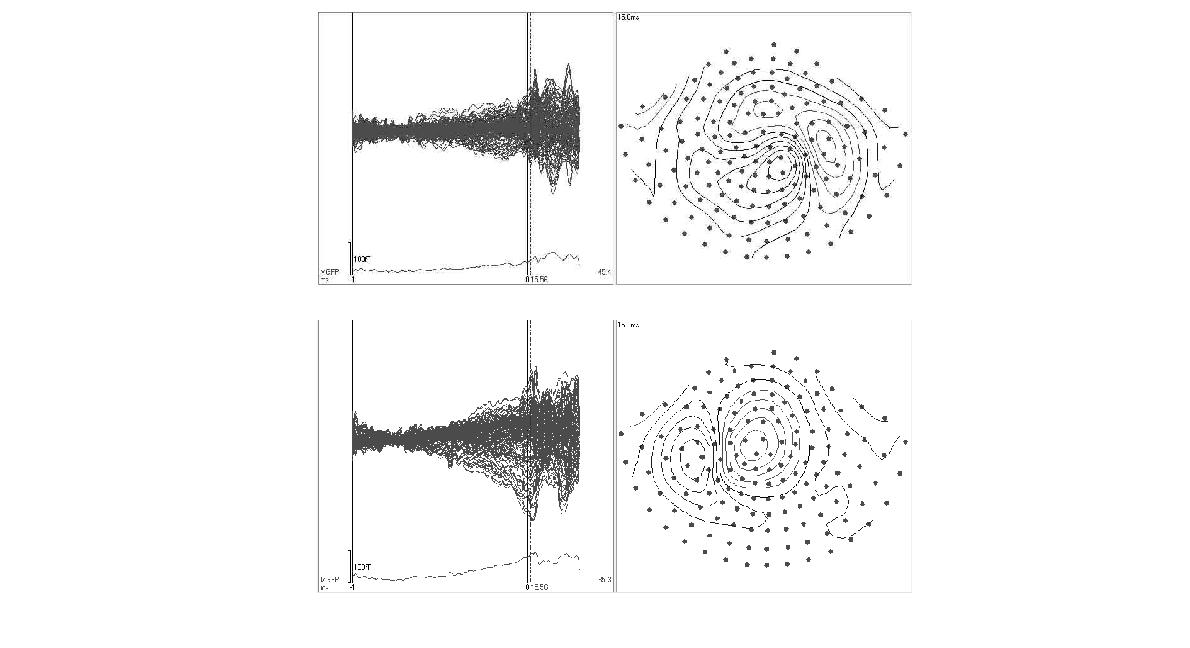 Averaged evoked magnetic fields in response to voluntary movement of (a) left and (b) right index finger.