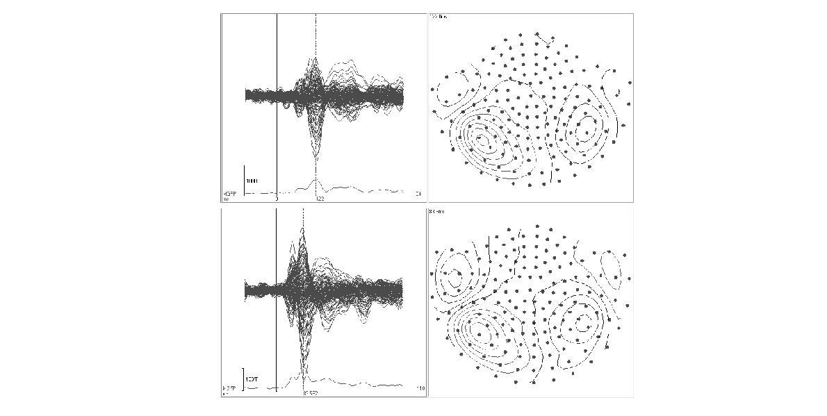 Averaged evoked magnetic fields in response to auditory stimuli generated by sound card (a) and direct A/D conversion (b).