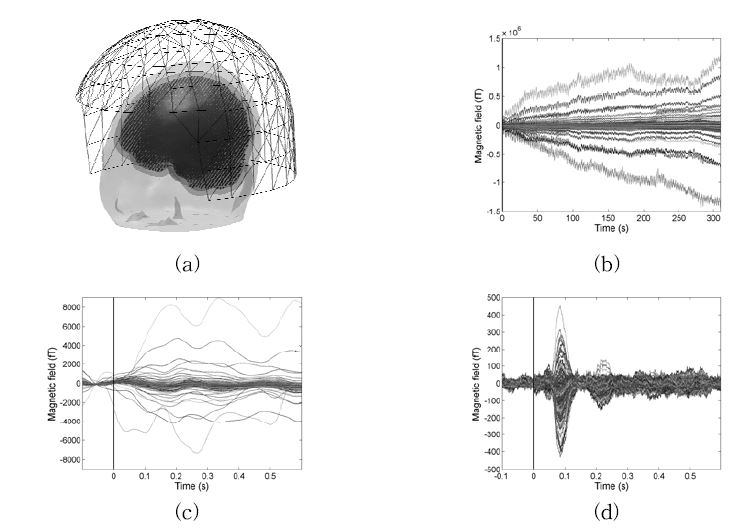 tSSP analysis of an auditory evoked field experiment with subject who equipped metal dental brace. (a) tSSP analysis setup. (b) recorded raw data. (c) averaged raw data. (d) averaged tSSP applied data.