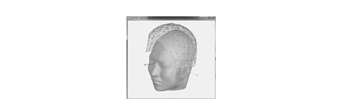 A Brainstorm generated image. KRISSMEG helmet surface was coregistered with a subject