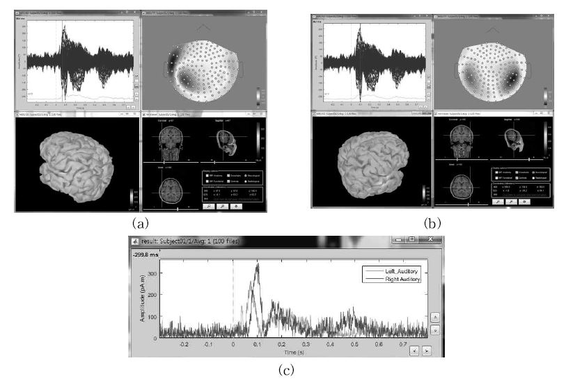 Examples of data analysis using Brainstorm software. MEG data was recorded using the KRISSMEG system while auditory stimulations were presented to the right ear of a subject