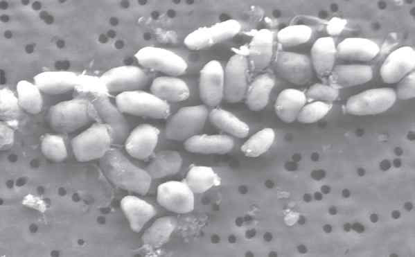 비소 함유 미생물(GFAJ-1)의 전자현미경 사진