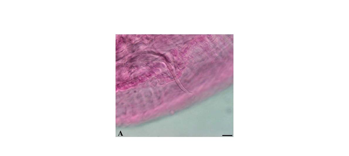 Haplotaxis n. sp. A. chaetae shape.(Scal bar=10㎛)