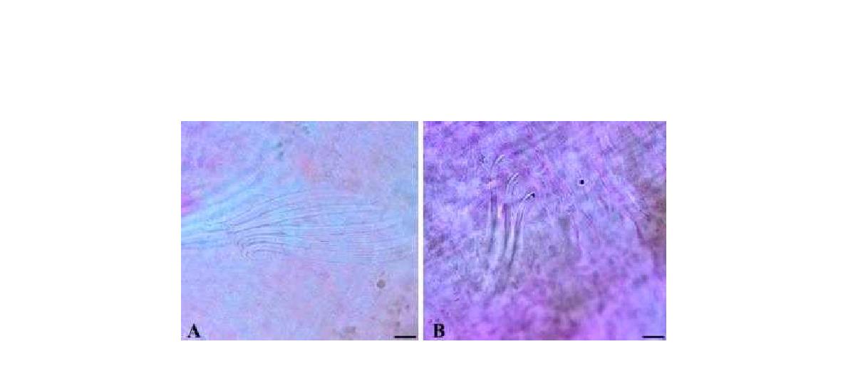 Rhyacodrilus stephensoni Černosvitov, 1941. A. penial chaetae, B. chaetae shape.(Scal bar=10㎛)