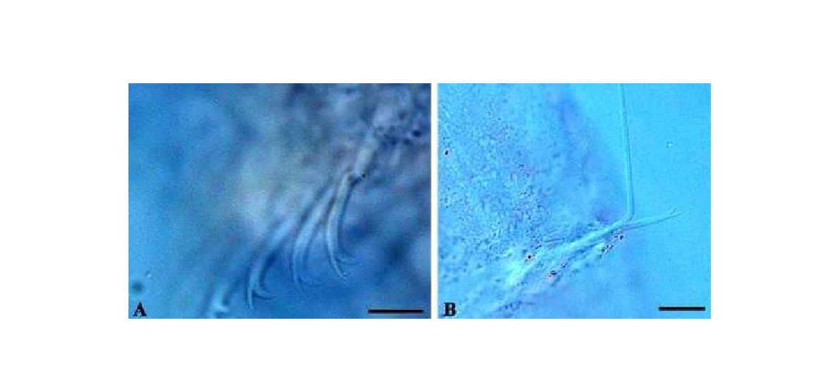 Piguetiella cf. amurensis. A.Ventral chaetae B. Dorsal chaeta. chaetae shape. (Scalbar=10㎛)