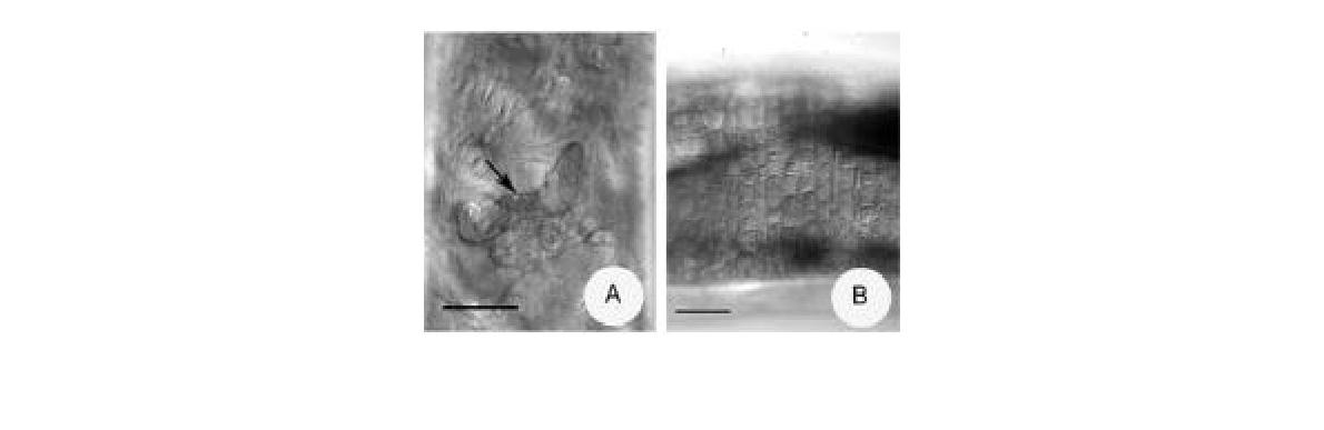 Micrographs of Achaeta brevivasa. A. Spermatheca (marked with arrow). B. Clitellar glands, dorsally view. Scale bars 50 μm.