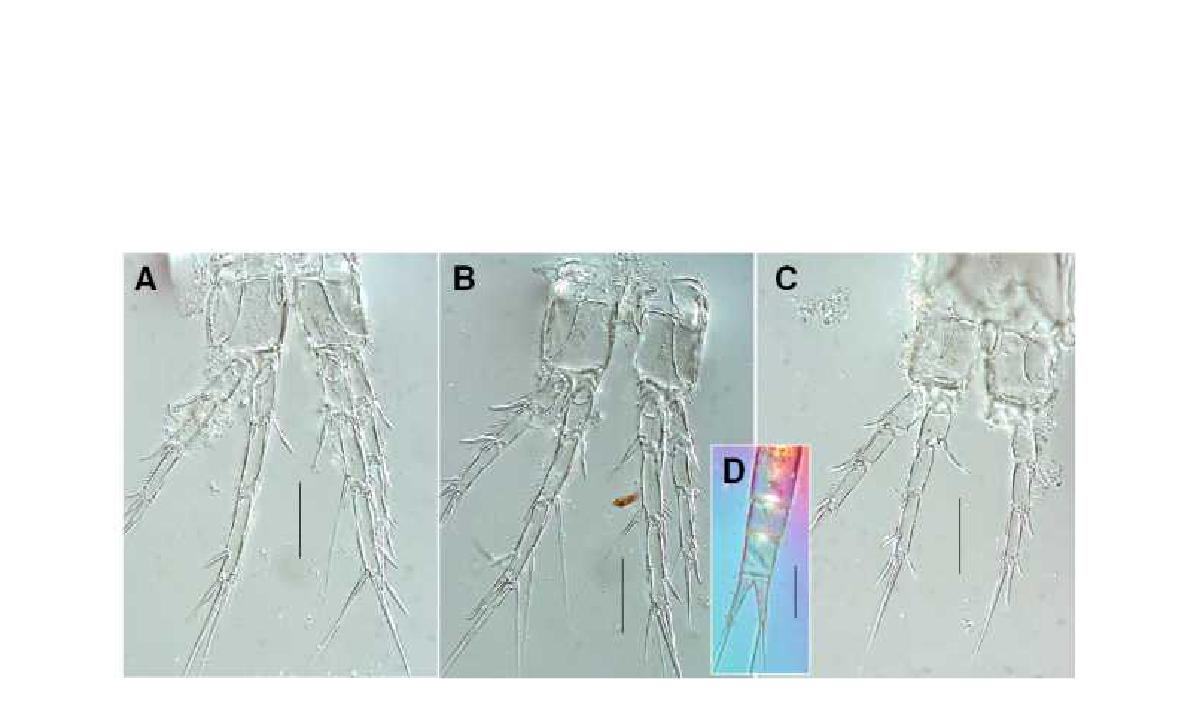 Brianolla n. sp. 2. female. A, P2, dorsal; B, P3, dorsal, C, P4, dorsal. Scales:A-C=0.02mm, D=0.2mm.