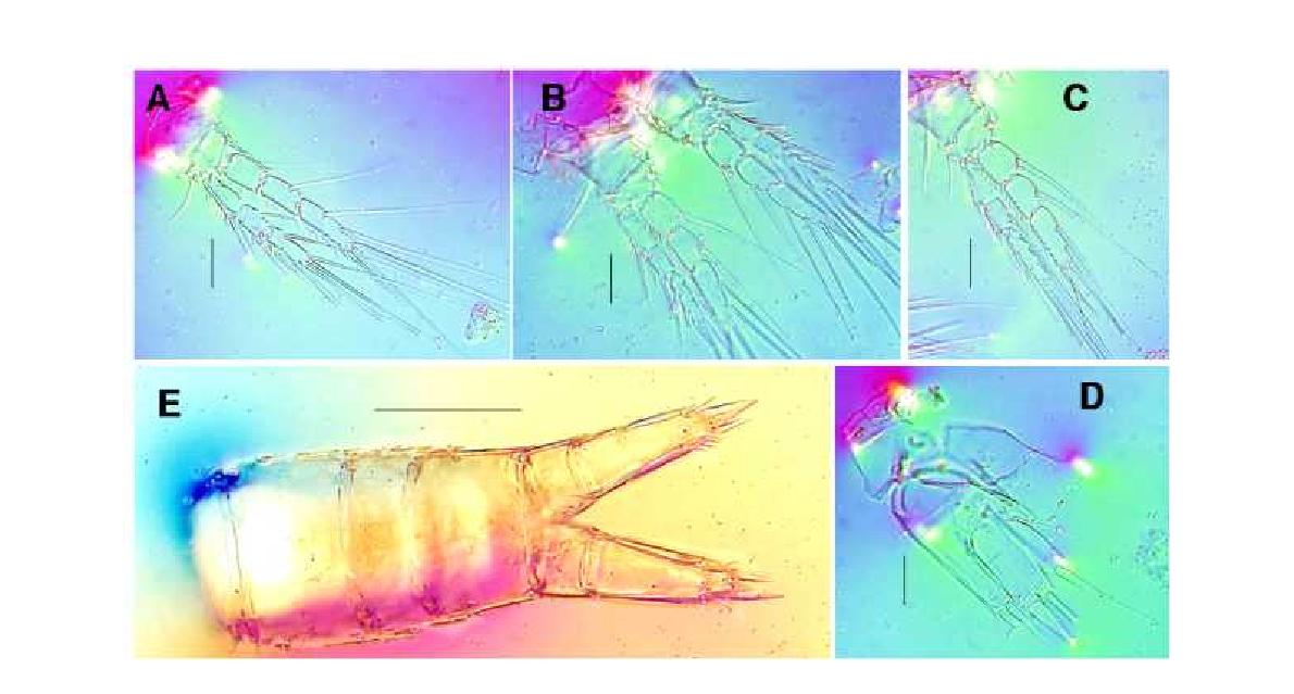 Pseudobradya n. sp. female. A, P1, dorsal; B, P3, dorsal, C, P4, dorsal; D, P5,dorsal; E, Urosome and caudal rami. Scales: A-D=0.02mm, D=0.2mm.