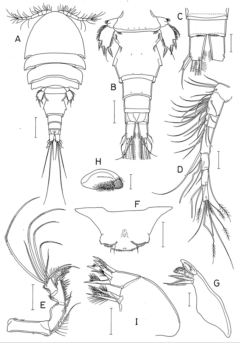 Hemicyclops n. sp. female.