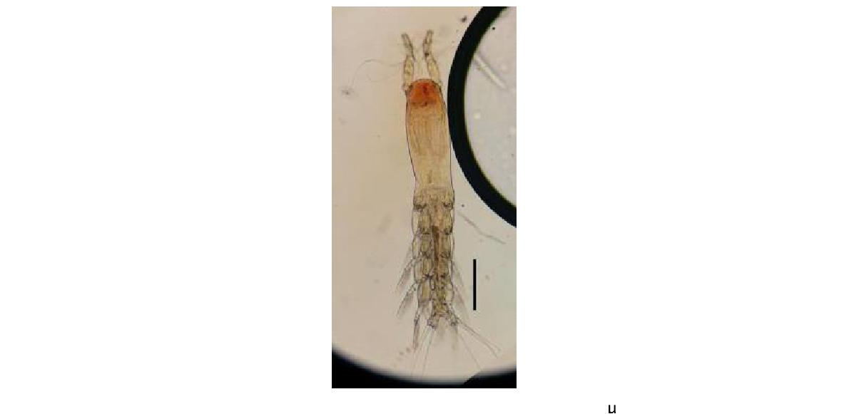 Monstrillopsis n. sp. Male. Habitus, Dorsal Scale bars: 300 μm