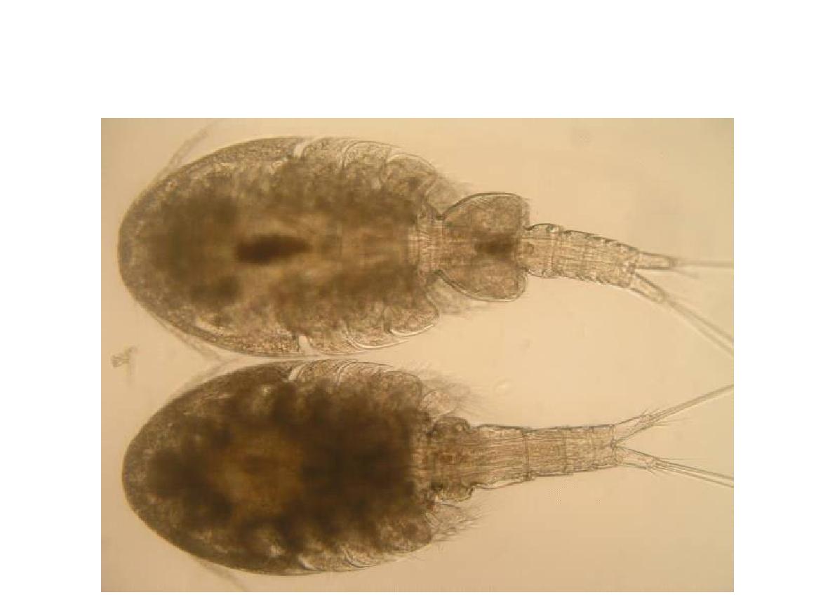 Hemicyclops tanakai. Male (top) and female (bottom) in dorsal view, ligh microsope photograph.